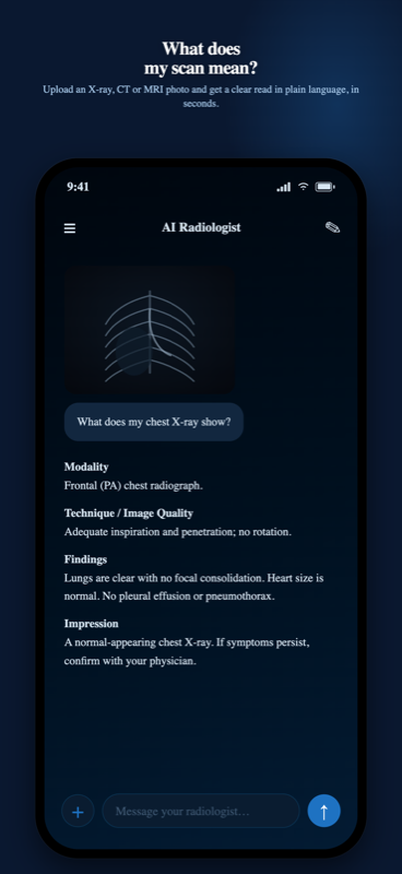 Conversation AI Radiologist analysant une radiographie pulmonaire, réponse structurée en modalité, technique et qualité d'image, constatations et impression